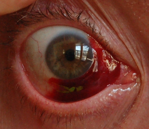 Look into my eye